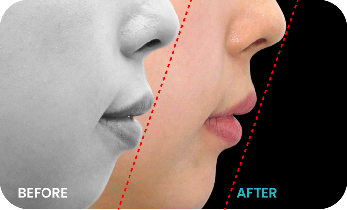 바노바기 일레븐 치과